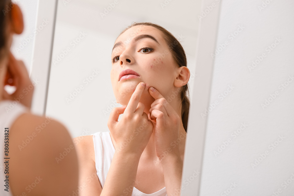 Young woman with acne problem squishing pimples near mirror Young woman with acne problem squishing pimples near mirror