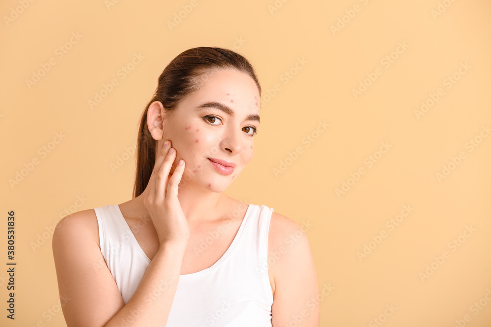 Young woman with acne problem on color background Young woman with acne problem on color background