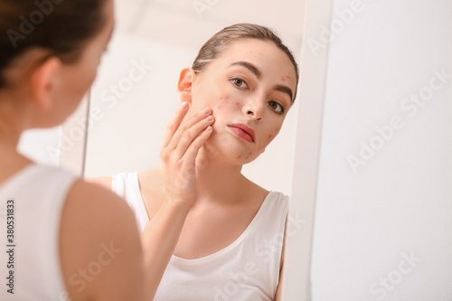 Young woman with acne problem looking in mirror