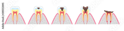 Tooth cross section_8 photo