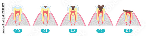 Tooth cross section_9