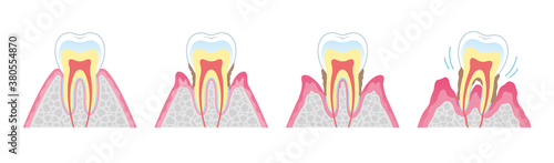 Tooth cross section_18