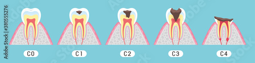 Tooth cross section_11