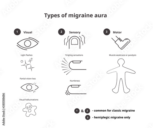 Types of migraine aura. Sensory, visual and motor aura of the classic and hemiplegic migraine