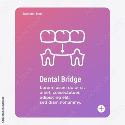 Dental bridge thin line icon. Dentistry, prosthesis. Tooth restoration. Vector illustration.