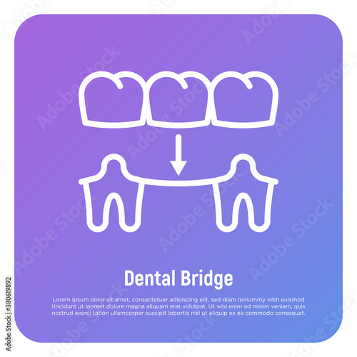 Dental bridge thin line icon. Dentistry, prosthesis. Tooth restoration. Vector illustration.