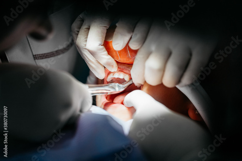 Child at dentist with conscious sedation