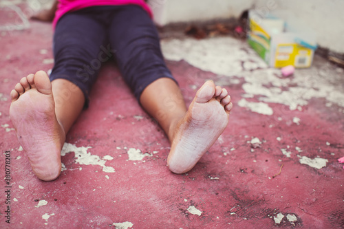 Young girl with chalky feet after playing hopscotch