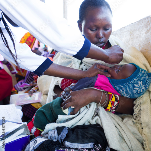 Baby receiving polio vaccine. Medical Clinic. Kenya. Africa. photo