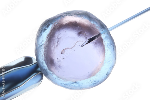Artificial insemination or in vitro fertilization photo