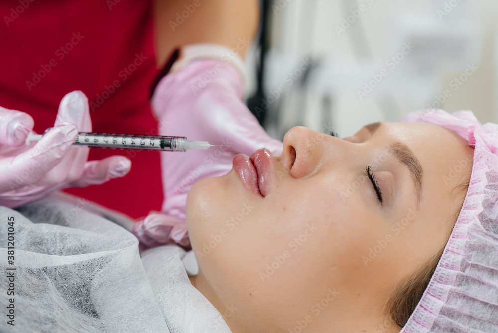 Cosmetology procedure for lip augmentation and wrinkle removal for a young beautiful girl. Cosmetology Cosmetology procedure for lip augmentation and wrinkle removal for a young beautiful girl. Cosmetology