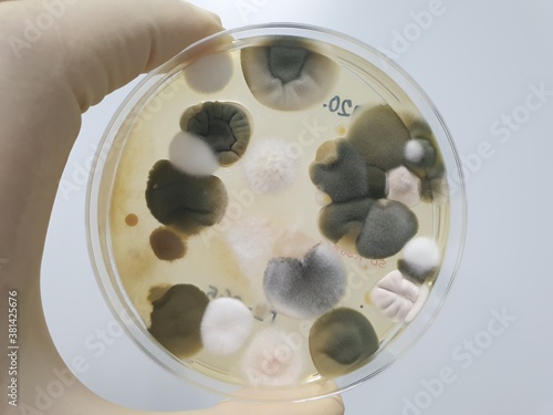 Results of culture of various fungal bacteria