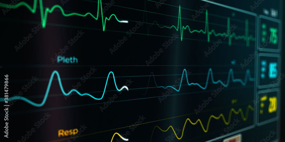 ECG Cardiac heart rate monitor in hospital