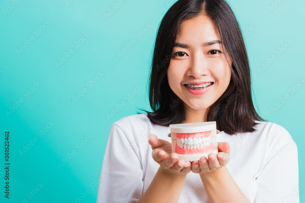 Portrait of Asian teen beautiful young woman smile have dental braces on teeth laughing she holding medical equipment dental model teeth, isolated on a blue background, Medicine and dentistry concept Portrait of Asian teen beautiful young woman smile have dental braces on teeth laughing she holding medical equipment dental model teeth, isolated on a blue background, Medicine and dentistry concept