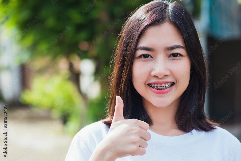 Portrait of Asian teen beautiful young woman smile have dental braces on teeth laughing outdoor, Medicine and dentistry concept Portrait of Asian teen beautiful young woman smile have dental braces on teeth laughing outdoor, Medicine and dentistry concept