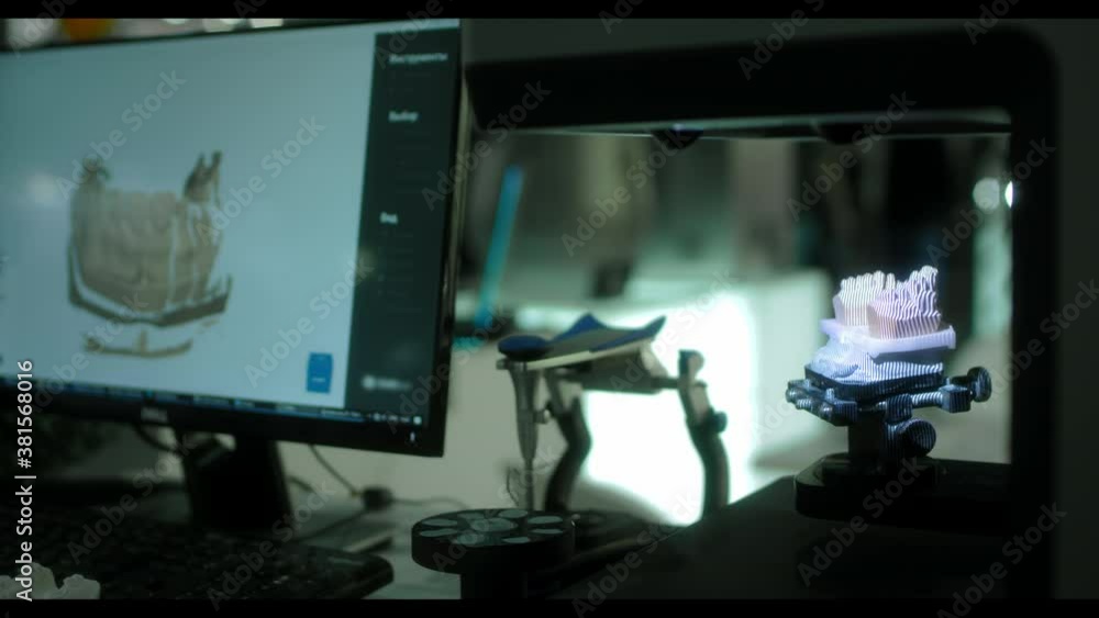 3D scanning of a plaster cast of the jaw. Modern dental technology. Ultraviolet rays travel through the teeth. 3d model on the screen 3D scanning of a plaster cast of the jaw. Modern dental technology. Ultraviolet rays travel through the teeth. 3d model on the screen