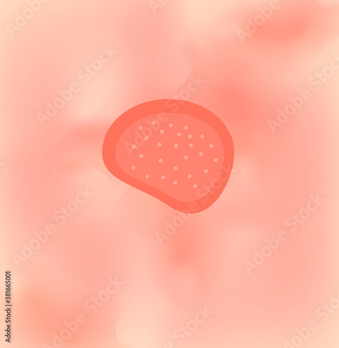 Ringworm on the skin. illustration on isolated background