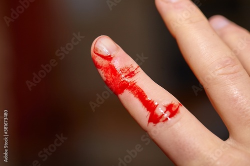 Canvas-taulu Finger cut and bleeding skin index finger on hand, in need of a plaster