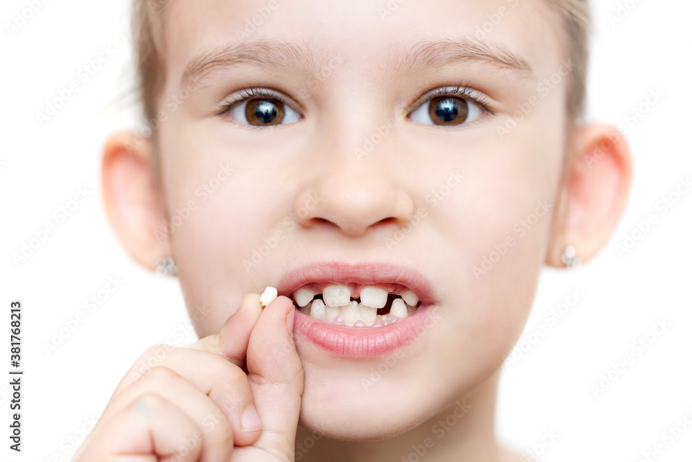 Losing teeth concept. Close up portrait of cute little girl holding milk tooth with opened mouth isolated on white background. Losing teeth concept. Close up portrait of cute little girl holding milk tooth with opened mouth isolated on white background.