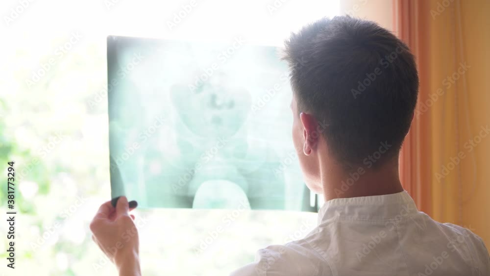 Young intern student examines x-ray of spine in clinic. Spine injury diagnosis. Concept of medicine, health care and people Young intern student examines x-ray of spine in clinic. Spine injury diagnosis. Concept of medicine, health care and people