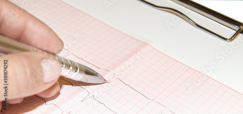 healthcare and medical concept - female doctor hands studies cardiogram holding pen