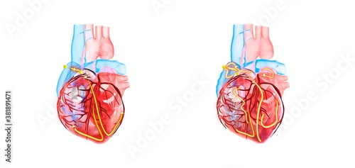 Foto Human heart anatomy, the yellow lines demonstrating the electrical (conduction) system of the heart