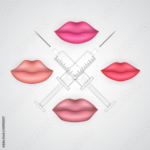 Lips 3d shapes of pink and red tints with crossed syringes. Cartoon vector glamorous lip volume augmentation, shape correction procedure poster. Female mouth icon for cosmetic fillers services.