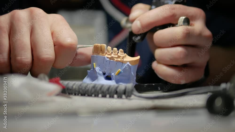 Dental technician work,tooth sharpening,denture tooth milling,dentistry