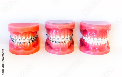 Teeth displays at orthodontic office 