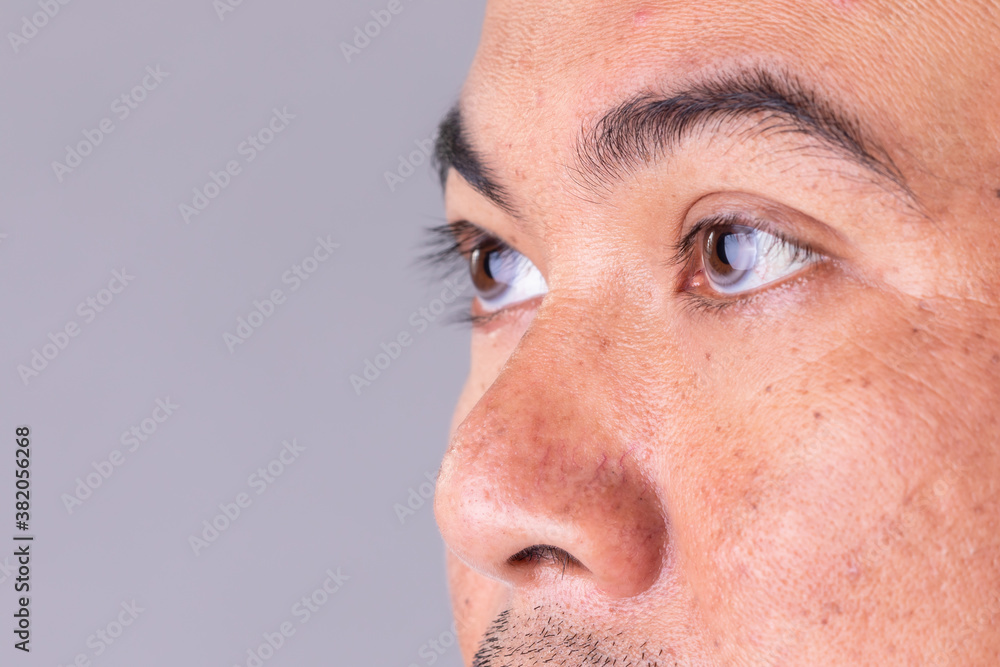 Face skin of asian man to show many skin problem. Men skin care concept on grey space background