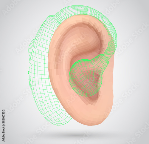 vector human ear. hearing treatment, plastic surgery, implantation