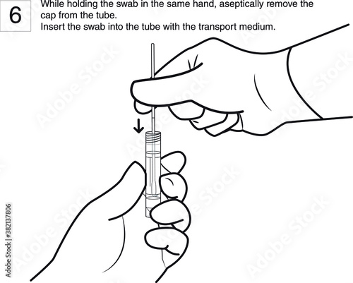 Step 6 : While holding the swab in the same hand, aseptically remove the cap from the tube. Insert the swab into the tube with the transport medium. line drawing