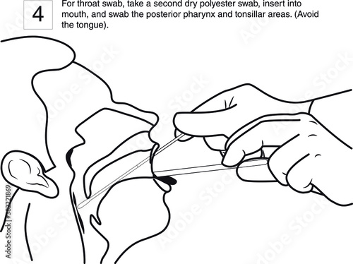 step 4 : For throat swab, take a second dry polyester swab, insert into mouth, and swab the posterior pharynx and tonsillar areas. (Avoid the tongue). line drawing