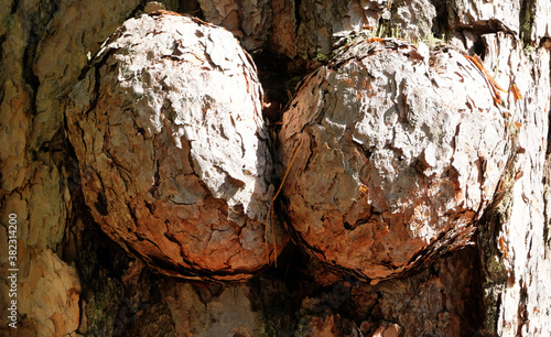 Huge excrescence on pine tree trunk. Sick diseased forest tree.