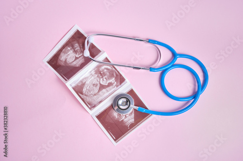a medical stethoscope and embryo picture on pink background