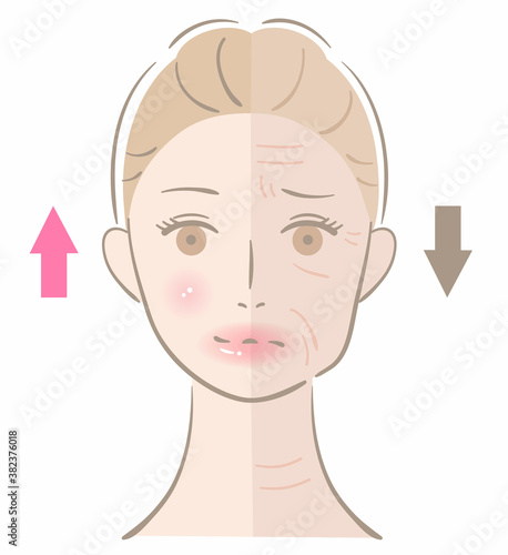 しわ　女性　ビフォアアフター