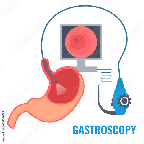 Gastroscopy procedure equipment for stomach disease diagnostics. Gastrointestinal tract examination. Medical concept. Vector illustration in flat style. Human body organ anatomy and health care.