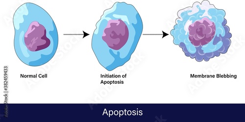 Stages of apoptosis from normal cell to final stage of formation of membrane blebbing vector