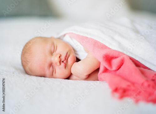 Newborn baby boy with cleft lip sleeping on a bed photo