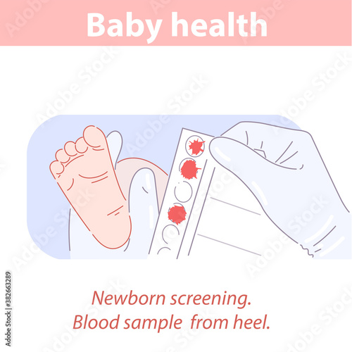Blood test taken from heel of newborn baby.