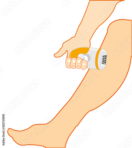 Leg of the person and instrument epilator © santa43
