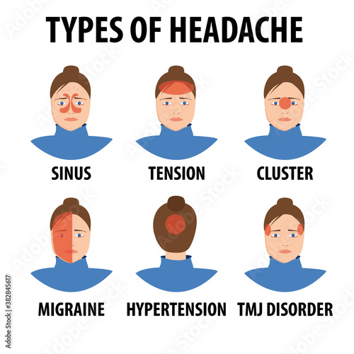 Cartoon headache types. Tension, migraine, sinus, cluster, allergy and hypertension headache. Female character with migraine illustration set. Unhappy woman suffering from illness. Medical infographic