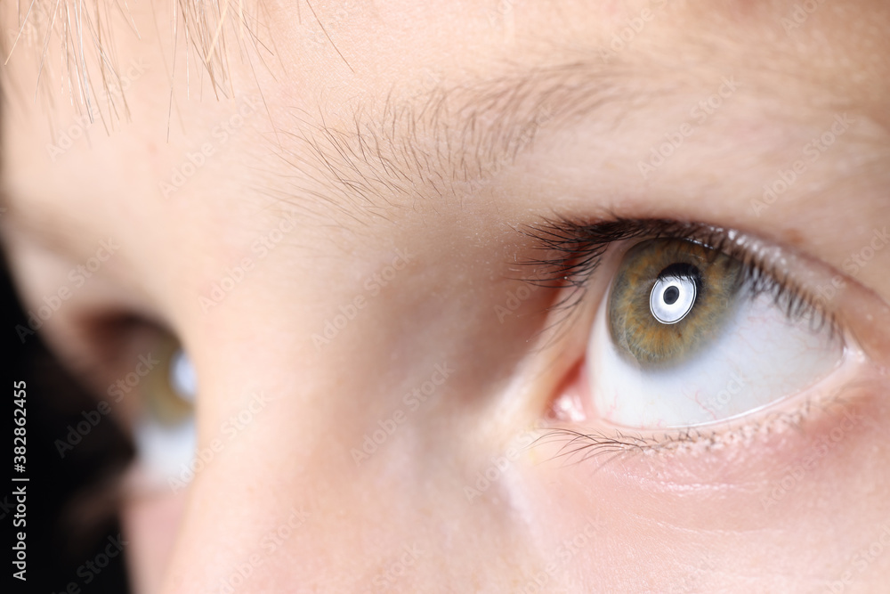 Obraz premium Close-up baby eyes look up. Treatment and correction of vision in children.