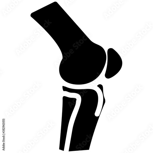 Joint fracture