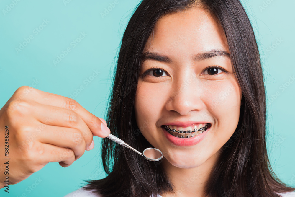 Asian teen beautiful young woman smile have dental braces on teeth laughing and have medical equipment tools for check tooth, isolated on a blue background, Medicine and dentistry concept Asian teen beautiful young woman smile have dental braces on teeth laughing and have medical equipment tools for check tooth, isolated on a blue background, Medicine and dentistry concept