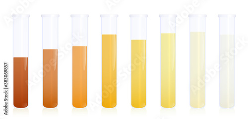 Urine samples, specimen test tubes with different colored urine - gradation from dark orange to yellow and clear liquid. Indicator of dehydration levels. Medical vector illustration on white.

