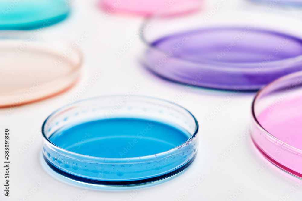Colorful Petri dish with media in a microbiology laboratory. Chemical research with different liquids. Colorful Petri dish with media in a microbiology laboratory. Chemical research with different liquids.