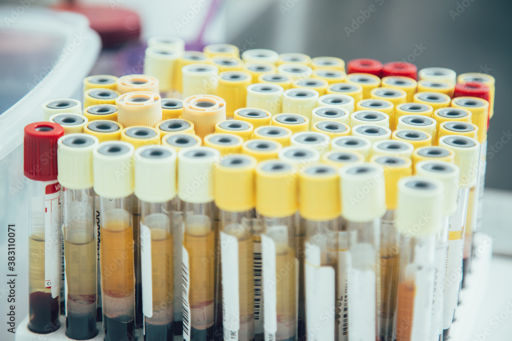 Various marked test tubes with substances in them Various marked test tubes with substances in them