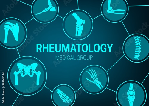 Rheumatology medicine, joint diseases treatment and x-ray banner. Human body skeleton parts, limbs and spine bones, pelvis and hip socket, foot, wrist and elbow, knee and shoulder joint vector