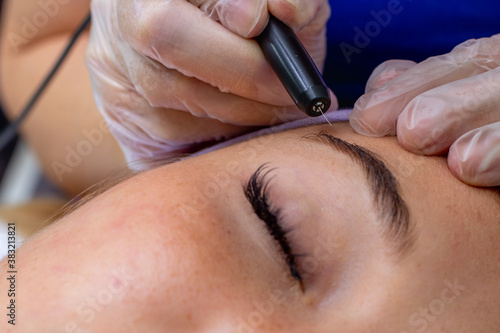 depilation of hair on a person's face, close-up.
